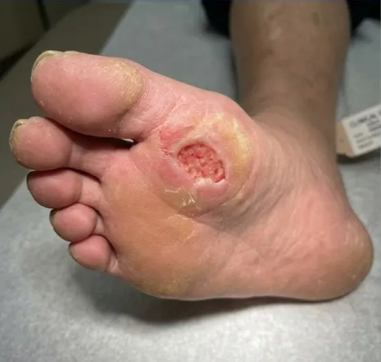 Before Treatment